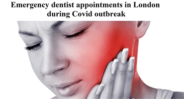Emergency dentist in London after Covid-19 coronavirus outbreak